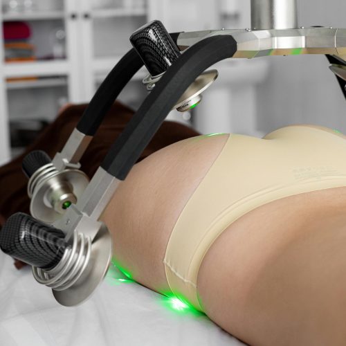 radiofrequenza della pelle del corpo di ragazza